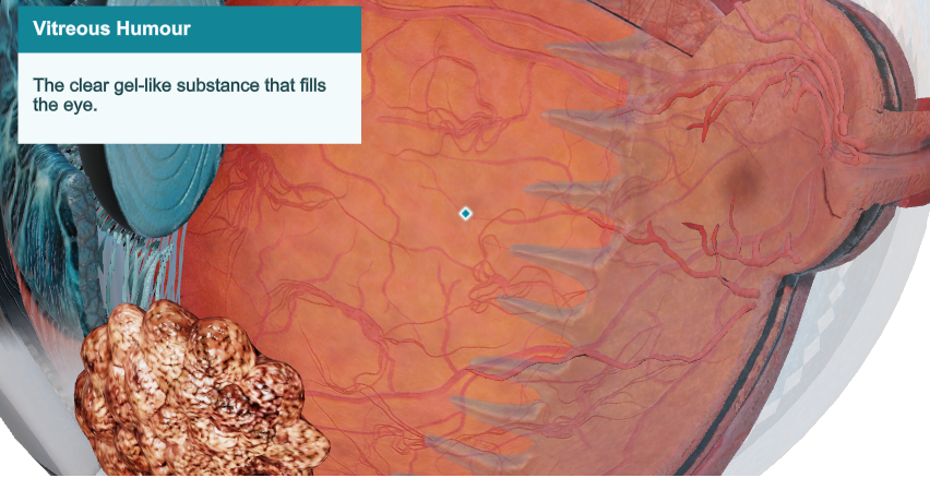 Vitreous Humour